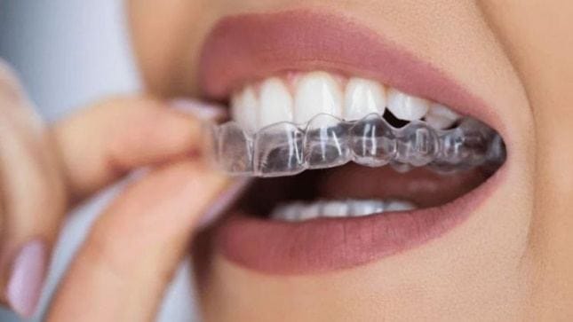 Braces & Aligners