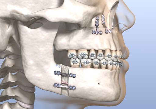 Oral & Maxillofacial Surgery