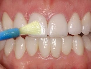 Preventive Dentistry 2