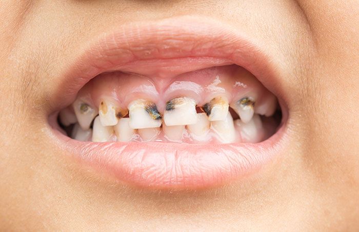 Pediatric Dentistry 1