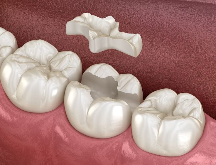 Restoration 2